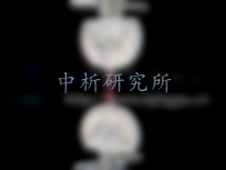 環拉伸試驗